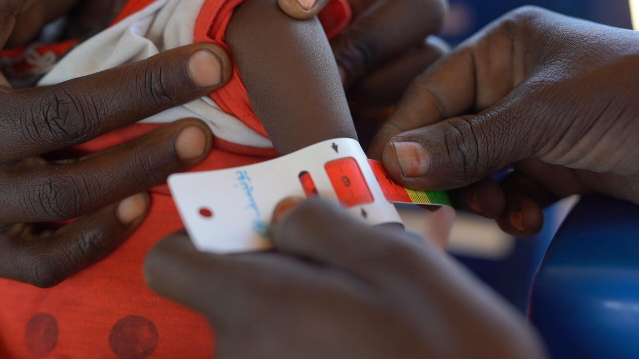 Inquérito nutricional revela níveis sem precedentes de subnutrição infantil numa região do Norte do Darfur, no Sudão
